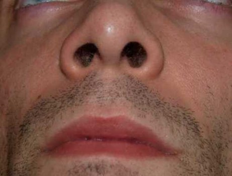 nostrils-by-david-shankbone-505f2-673727-8532.jpg